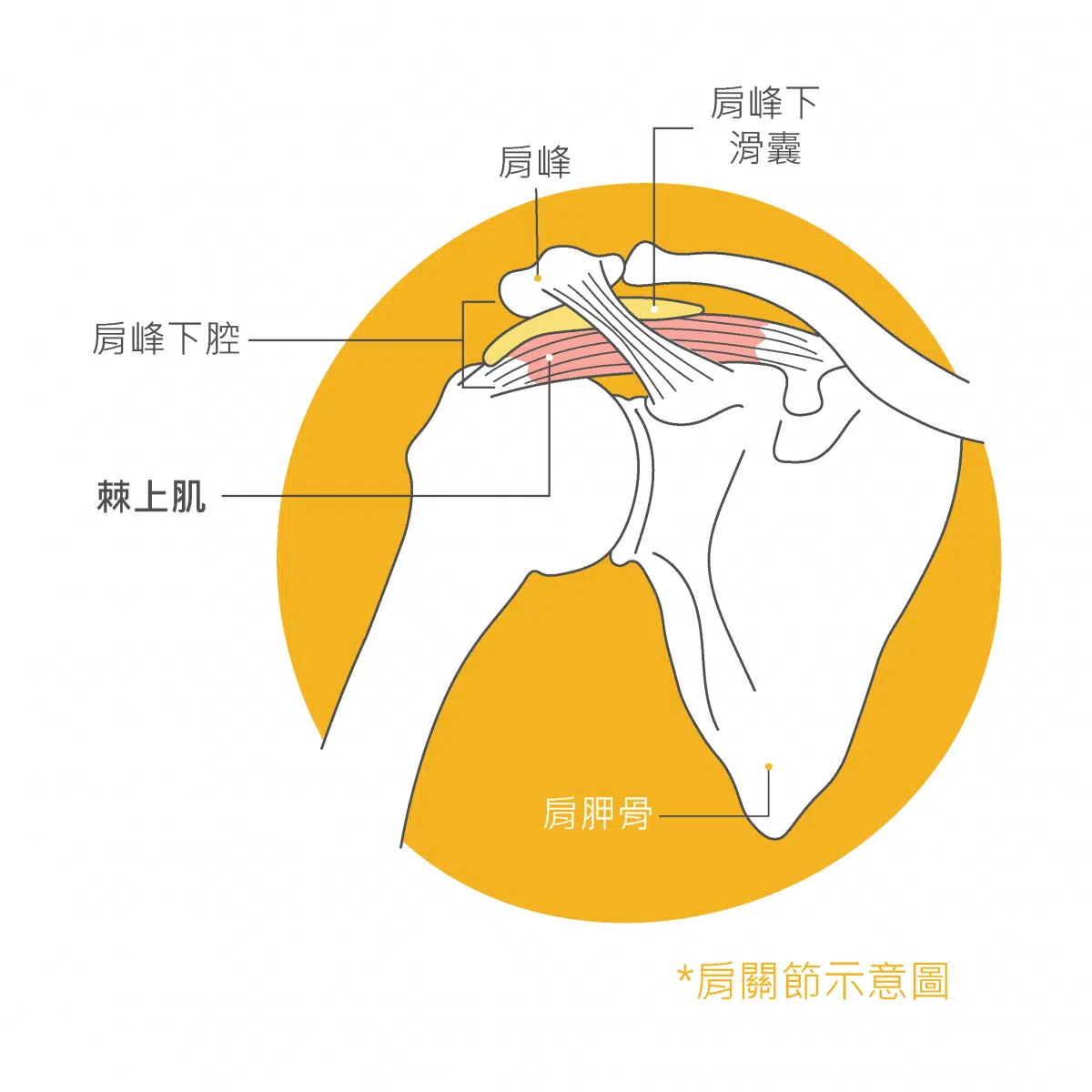 肩夾擠症候群-肩膀痛，可能是游泳肩