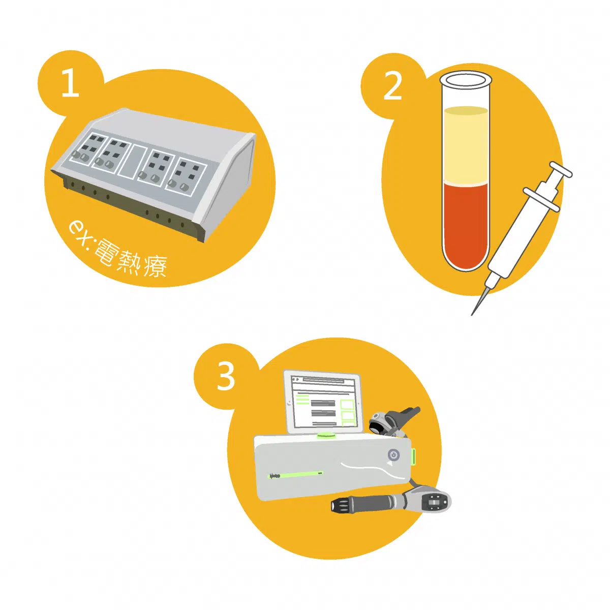 肩夾擠症候群-肩膀痛，可能是游泳肩
